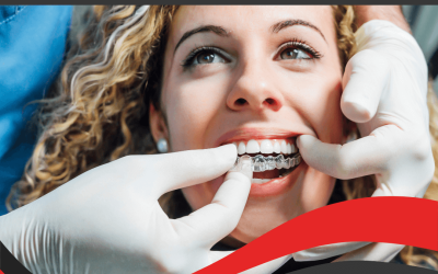The Clear Choice: Why More Adults Are Choosing Invisalign®
